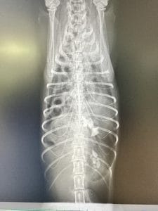 外傷性横隔膜ヘルニアの胸腹部レントゲン画像