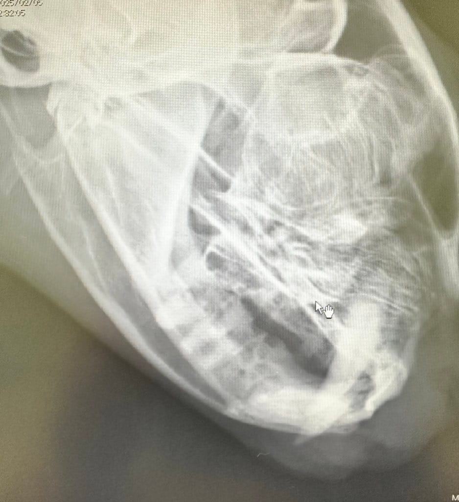 抜歯後に臼歯の根本が折れて残っていた猫のレントゲン画像