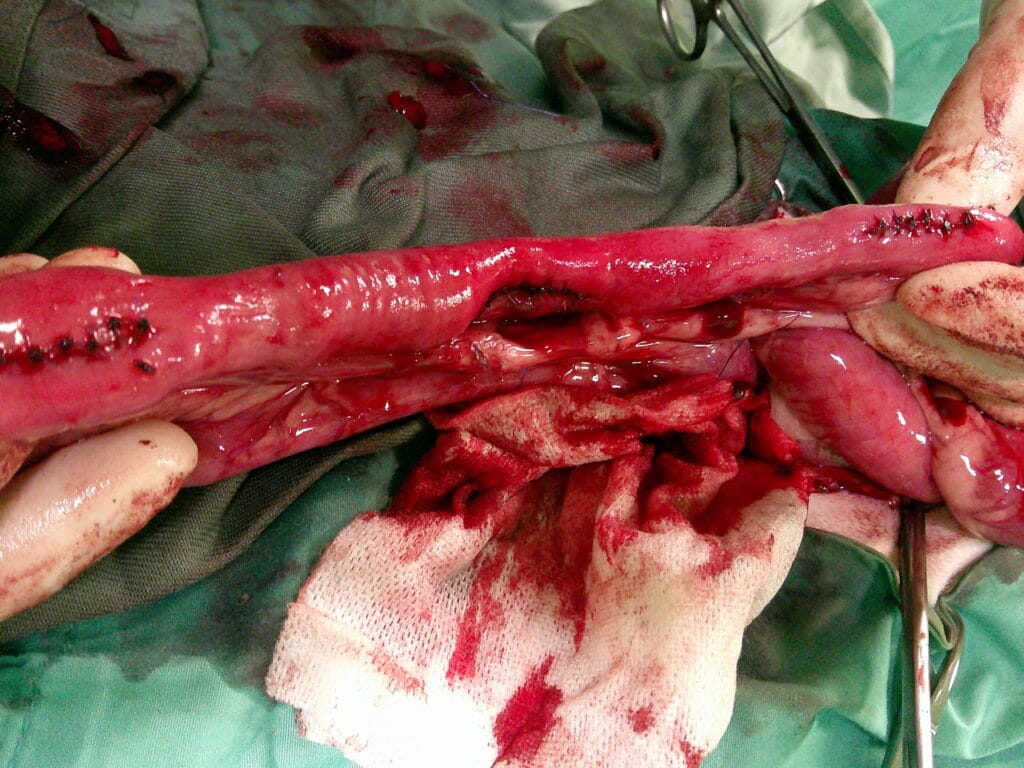 腸閉塞で腸切開を行っている様子