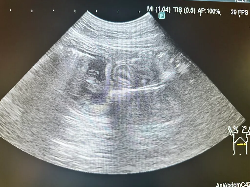 ひも状異物で腸閉塞を起こしている腸のエコー写真